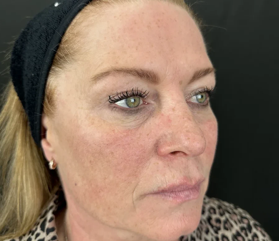 Full-face clinical assessment